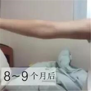 手臂吸脂手術八個月了，看看我的前后對比果圖片吧~~