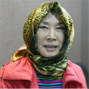 做面部拉皮除皺手術(shù)半年多了，看看我的恢復(fù)過程照片吧，果不錯~