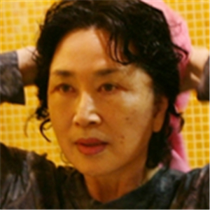 做面部拉皮除皺手術(shù)半年多了，看看我的恢復(fù)過程照片吧，果不錯~