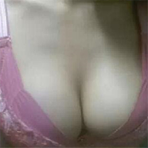 分享娜高假體豐胸手術(shù)恢復(fù)過程，還有前后對比果圖片哦~~