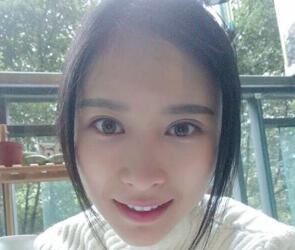 自體脂肪面部填充三個(gè)月了，恢復(fù)的很好，給你們看看果怎么樣吧，是不是很美麗了~