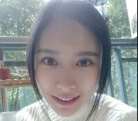 大腿吸脂做自體脂肪面部填充三個(gè)月了，分享給大家