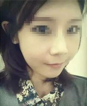 【20天康復(fù)記錄】隆鼻+面部脂肪填充，遇見(jiàn)更美的自己