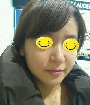 光子嫩膚后，整個人漂亮多了