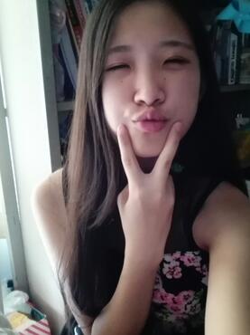 埋線雙眼皮15天恢復記錄