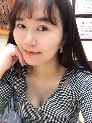 自體脂肪隆胸后變自信了 吳建明教授做的