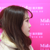 我的自體脂肪隆鼻后活脫脫的把我變成了網(wǎng)紅了哈哈  美~~~