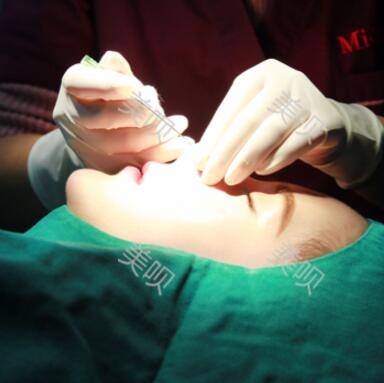 我的自體脂肪隆鼻后活脫脫的把我變成了網(wǎng)紅了哈哈  美~~~