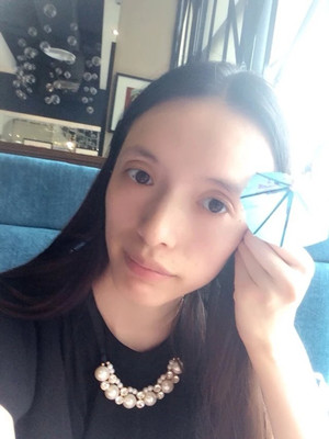 玻尿酸面部填充前后過程及對比圖片，來看看果如何