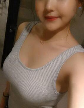 成都艾米麗自體脂肪隆胸三個(gè)月啦~