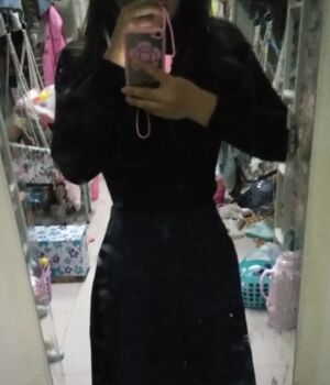 腰腹吸脂后腰線好看太多，肚子也小了