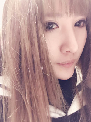 玻尿酸隆鼻后意想不到的果 陸忠凱做的