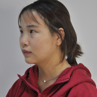 在蘇州常春藤做的硅膠假體隆鼻為大家分享下我的恢復(fù)全過程吧