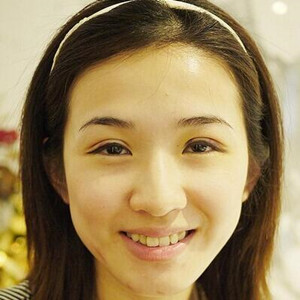 雙眼皮手術(shù)前后過(guò)程以及真實(shí)案例分享