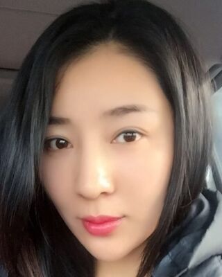 埋埋蛋白線.提升整個(gè)面部年輕很多，小V臉也出來了