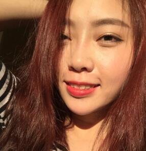 自體脂肪隆鼻、墊下巴、豐蘋果肌前后對(duì)比圖和恢復(fù)過程分享