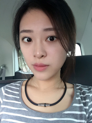 翟爽給我打玻尿酸隆鼻做出了假體的感覺(jué)