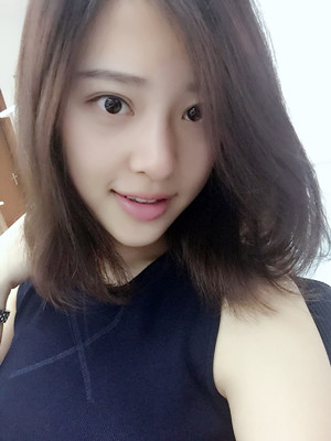 翟爽給我打玻尿酸隆鼻做出了假體的感覺(jué)