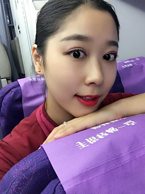 你們來(lái)看看翟爽做的切開(kāi)雙眼皮怎么樣