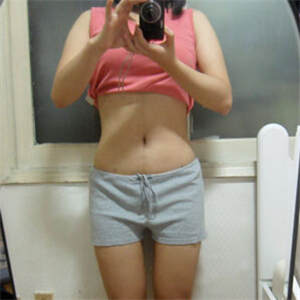 京韓做腰腹吸脂四個(gè)月的恢復(fù)照片，喬愛(ài)軍醫(yī)生的技術(shù)很好哦~