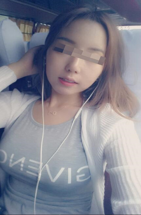 小胸和大胸就差一個(gè)李鴻君做的假體隆胸手術(shù)