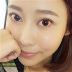 去年做了面部埋埋蛋白線.提升緊致除皺，分享恢復(fù)前后對比果圖片~