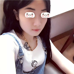 愛斯克做了高強(qiáng)度聚焦超聲5個月了，看看我的果照片，不錯哦~~