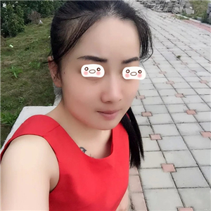 愛斯克做了高強(qiáng)度聚焦超聲5個月了，看看我的果照片，不錯哦~~