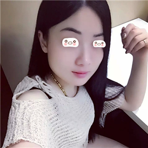 愛斯克做了高強(qiáng)度聚焦超聲5個月了，看看我的果照片，不錯哦~~