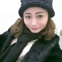 玻尿酸墊下巴后改變了我的大餅?zāi)樄镣淄椎? /> </a>
<a href=