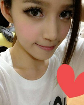 記錄了隆鼻三個(gè)月前后的恢復(fù)過(guò)程，希望可以幫到有需要的朋友