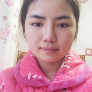 磨骨磨下頜角半年了，分享恢復過程和前后對比果照片哦~