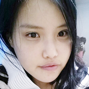 做下頜角整形手術(shù)半年了，給你們看看恢復過程照片吧~