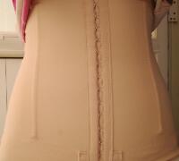 抽脂減肥瘦腰腹親身經(jīng)歷和前后對(duì)比圖分享