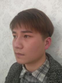 注射注射瘦臉B****之前的圖片