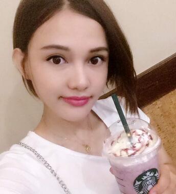 玻尿酸豐太陽7天果圖 愛悅麗格豐太陽穴一個月啦~