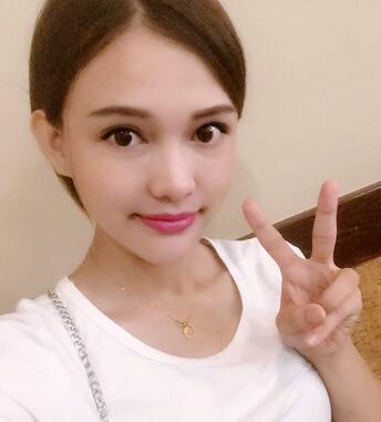 玻尿酸豐太陽7天果圖 愛悅麗格豐太陽穴一個月啦~