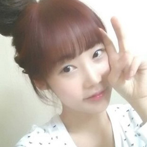 做地包天矯正手術(shù)五個月了，恢復(fù)得不錯，有前后對比果圖片哦~