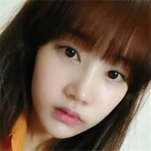 做地包天矯正手術(shù)五個月了，恢復(fù)得不錯，有前后對比果圖片哦~