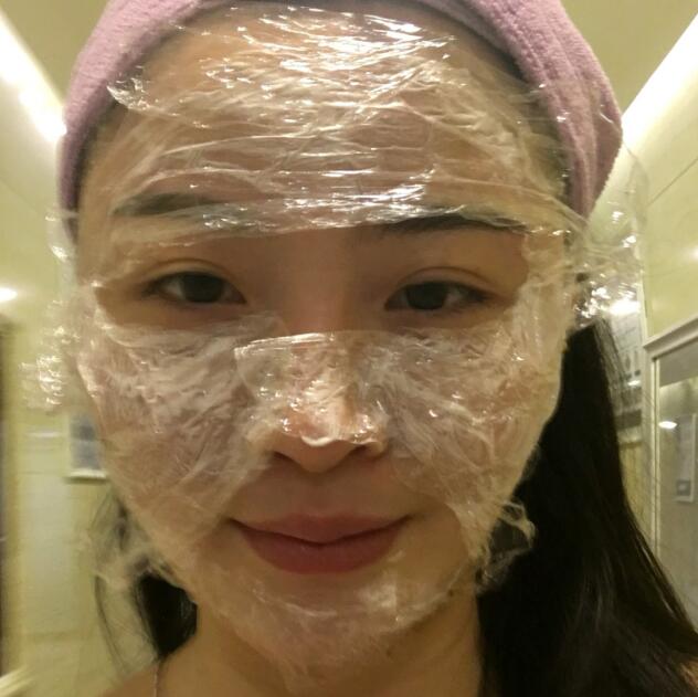 分享我的去胎記過程遺傳性雀斑終于被甩掉了