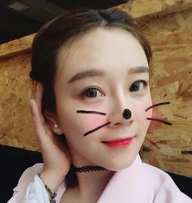 武漢中愛自體脂肪豐唇+面部填充恢復(fù)記錄