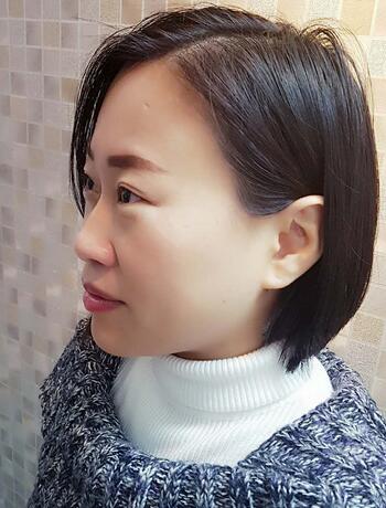 武漢中愛注射瘦臉去魚尾紋一個(gè)月