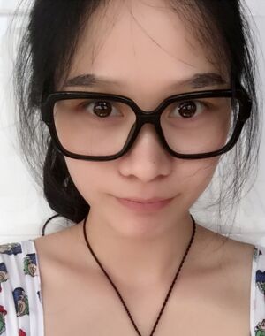 很淡的眉毛做完眉毛種植之后濃密多了