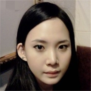 自體脂肪移植隆鼻手術前后對比果圖片，恢復過程分享給大家~