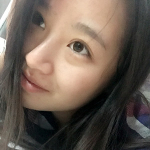 做了玻尿酸隆眉弓，感覺棒棒噠