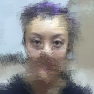 做了眼部電波l皮，一下子年輕了不少啊