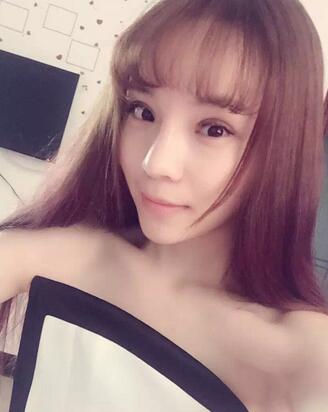 梨花雨隆鼻整形的恢復(fù)經(jīng)歷