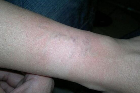 洗紋身還是要找一個(gè)靠譜的地方 快來(lái)看看我的果