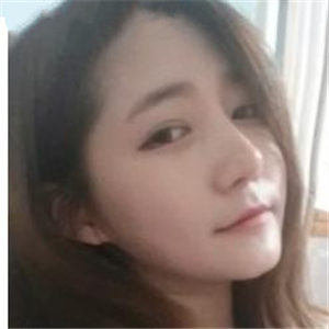 去年做的雙眼皮，分享恢復(fù)過程和前后對比果圖片~