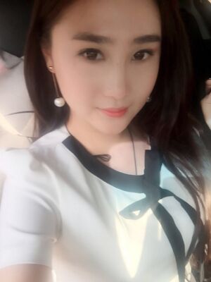 膨體隆鼻改變了我的塌鼻子，整體都精致不少